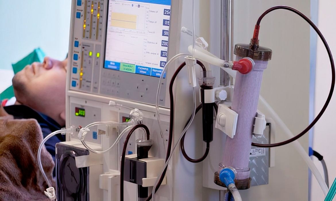 Doença Renal Crônica no Brasil: Estudo Alerta Para Subdiagnóstico